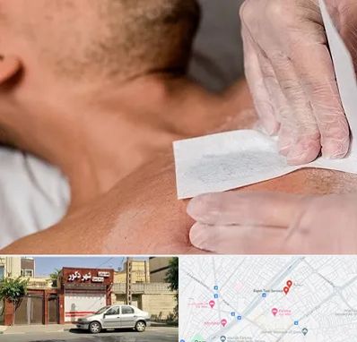 اپیلاسیون آقایان در باجک قم