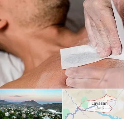 اپیلاسیون آقایان در لواسان