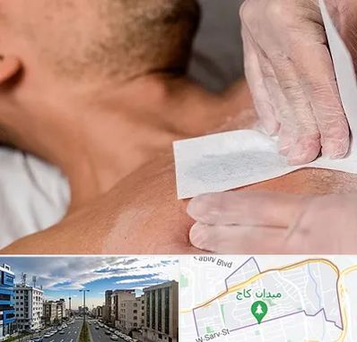 اپیلاسیون آقایان در سعادت آباد 