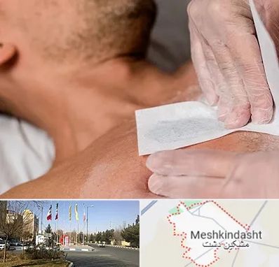 اپیلاسیون آقایان در مشکین دشت
