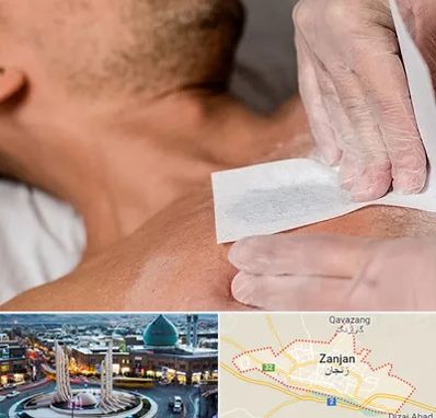 اپیلاسیون آقایان در زنجان