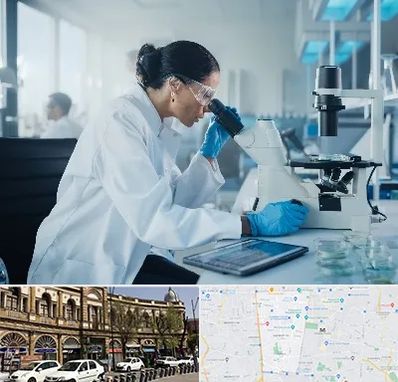 آزمایشگاه HPV در منطقه 11 تهران 