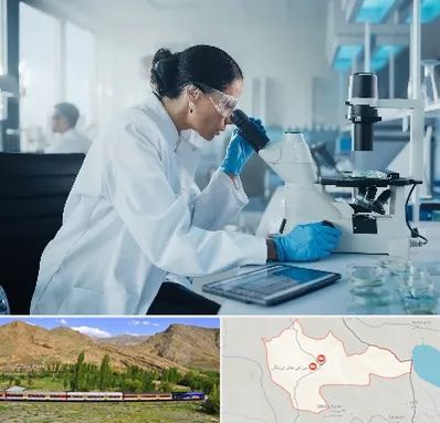 آزمایشگاه HPV در خاش