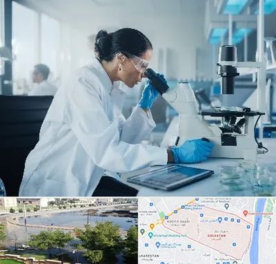 آزمایشگاه HPV در گلستان اهواز