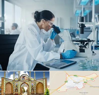 آزمایشگاه HPV در سمنان