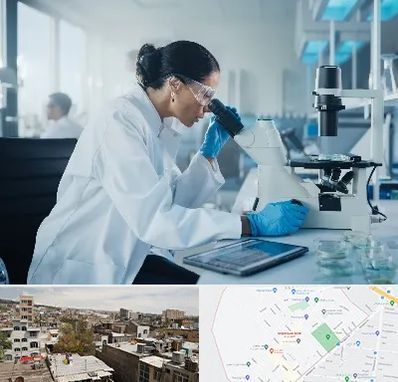 آزمایشگاه HPV در شمیران نو