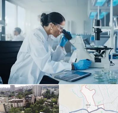 آزمایشگاه HPV در اوین