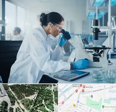 آزمایشگاه HPV در سالاریه قم