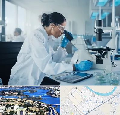 آزمایشگاه HPV در کوروش اهواز