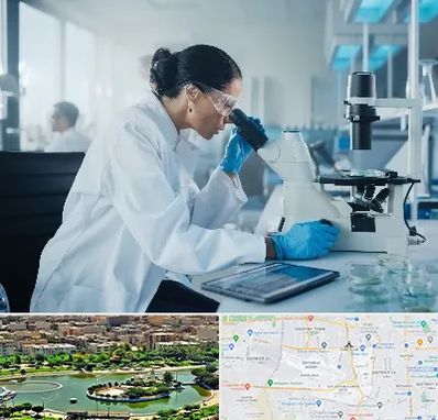 آزمایشگاه HPV در منطقه 9 تهران 