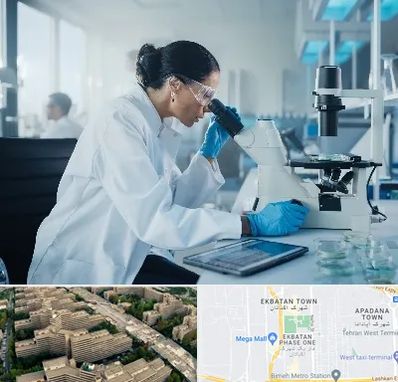 آزمایشگاه HPV در اکباتان 