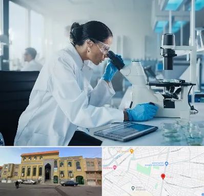 آزمایشگاه HPV در زنبیل آباد قم