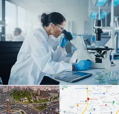 آزمایشگاه HPV در سبلان 