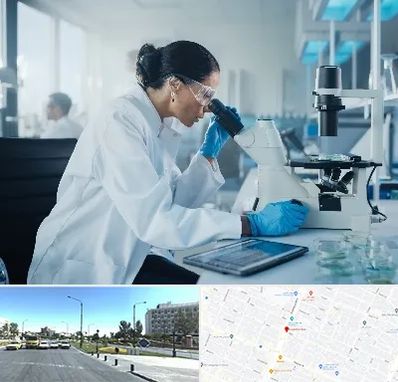 آزمایشگاه HPV در بلوار کلاهدوز مشهد