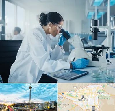 آزمایشگاه HPV در تهران