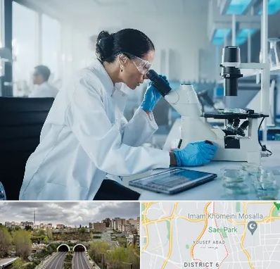 آزمایشگاه HPV در یوسف آباد 