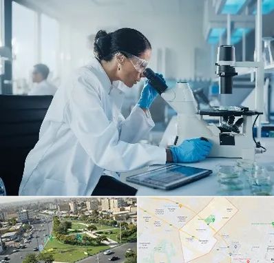 آزمایشگاه HPV در کمال شهر کرج