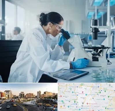 آزمایشگاه HPV در منطقه 7 تهران 