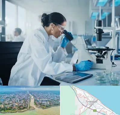 آزمایشگاه HPV در تنکابن