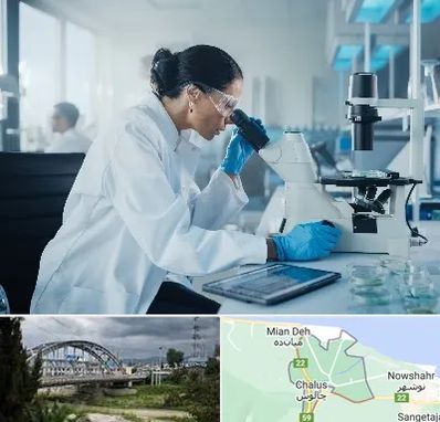 آزمایشگاه HPV در چالوس