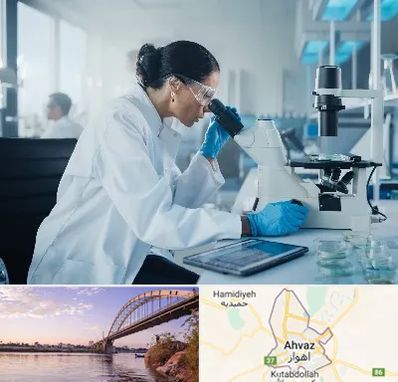 آزمایشگاه HPV در اهواز