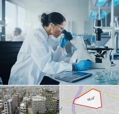 آزمایشگاه HPV در آذری