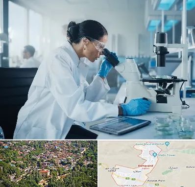 آزمایشگاه HPV در دماوند