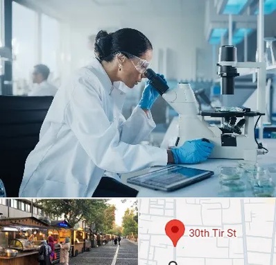 آزمایشگاه HPV در سی تیر