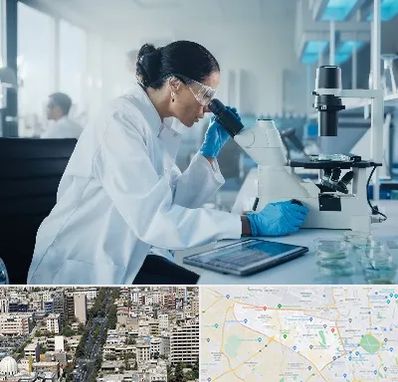 آزمایشگاه HPV در منطقه 18 تهران 