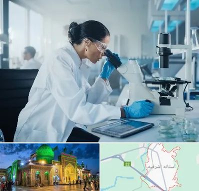 آزمایشگاه HPV در آستانه اشرفیه
