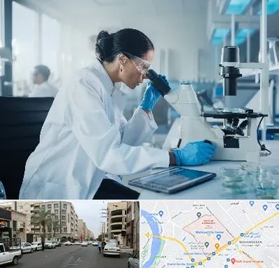 آزمایشگاه HPV در زیتون کارمندی اهواز