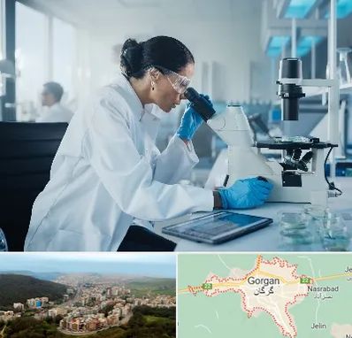 آزمایشگاه HPV در گرگان