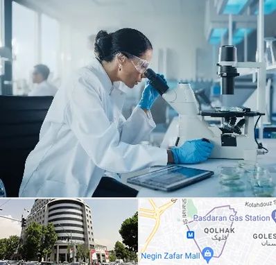 آزمایشگاه HPV در قلهک 