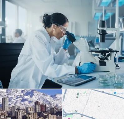 آزمایشگاه HPV در ازگل