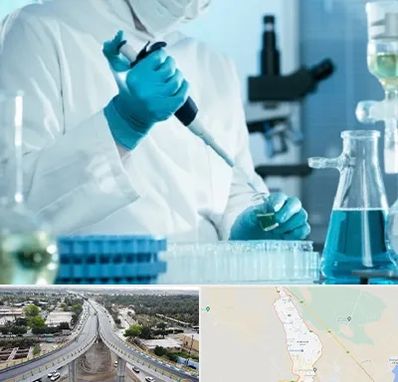 آزمایشگاه HIV در اندیمشک