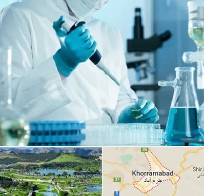 آزمایشگاه HIV در خرم آباد