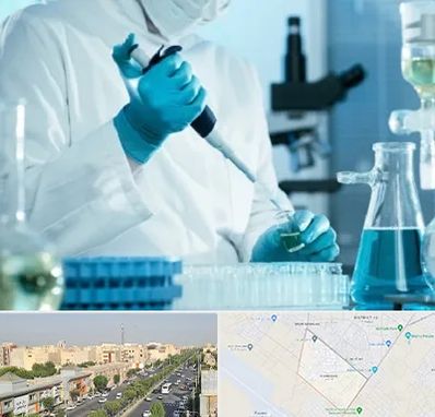 آزمایشگاه HIV در کیانمهر کرج