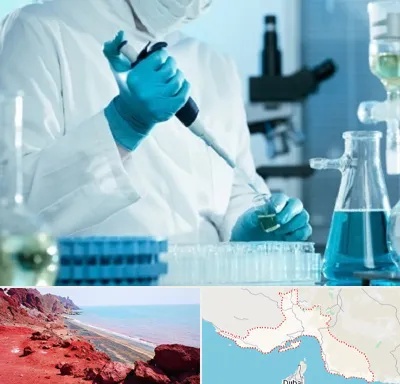 آزمایشگاه HIV در هرمزگان