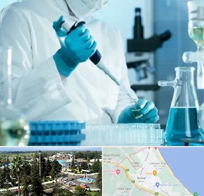 آزمایشگاه HIV در رودسر