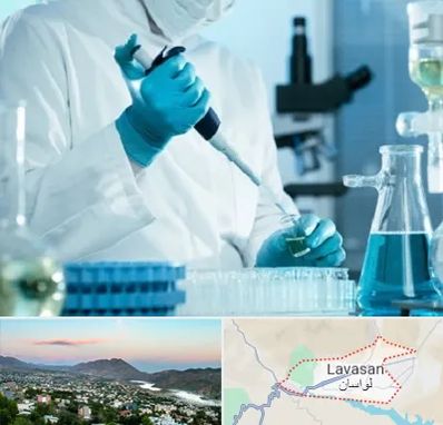 آزمایشگاه HIV در لواسان