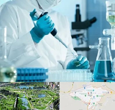 آزمایشگاه HIV در بجنورد