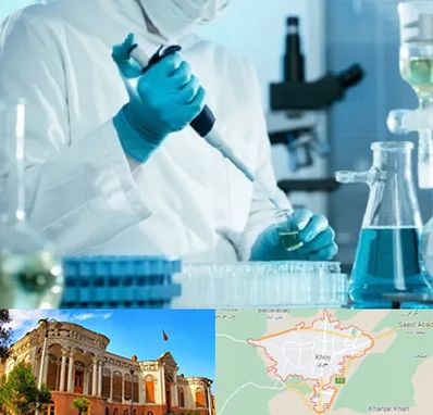 آزمایشگاه HIV در خوی