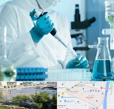 آزمایشگاه HIV در گلستان اهواز