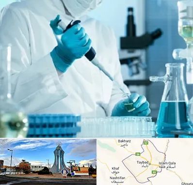 آزمایشگاه HIV در تایباد