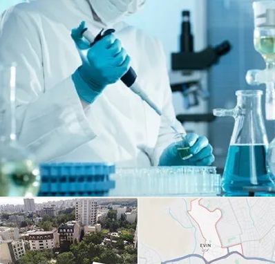 آزمایشگاه HIV در اوین