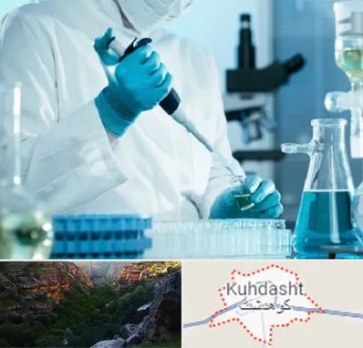 آزمایشگاه HIV در کوهدشت