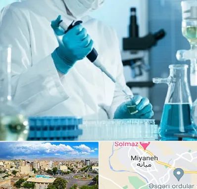 آزمایشگاه HIV در میانه