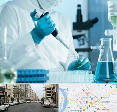 آزمایشگاه HIV در زیتون کارمندی اهواز