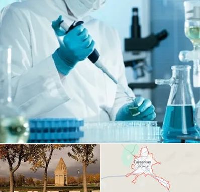 آزمایشگاه HIV در تویسرکان