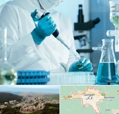 آزمایشگاه HIV در گرگان